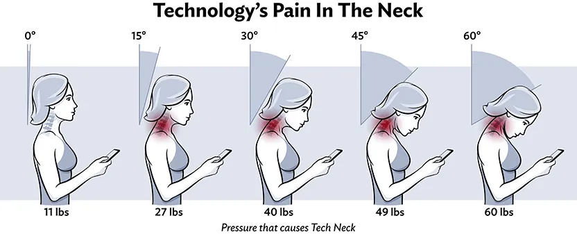 Tech Neck