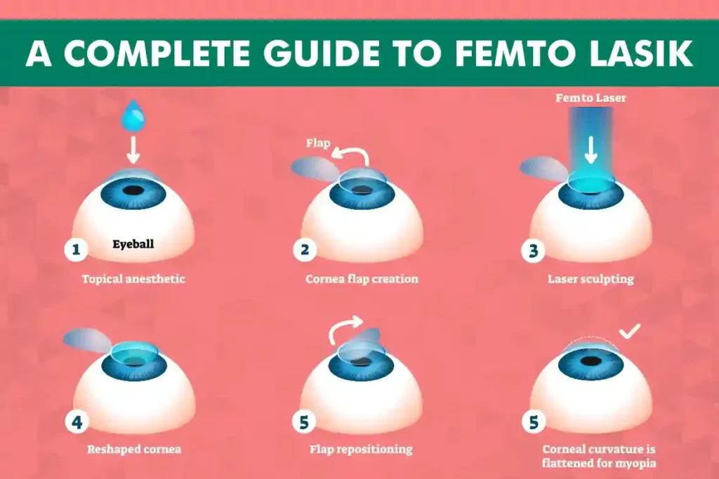 Astigmatism eye surgery in India