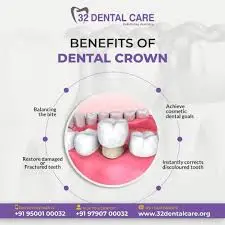 Dental Crowns