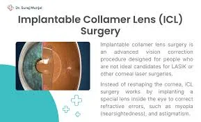 Astigmatism eye surgery in India